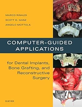 [B9780323278034] Computer-Guided Applications for Dental Implants, Bone Grafting, and Reconstructive Surgery (adapted translation): 1ed