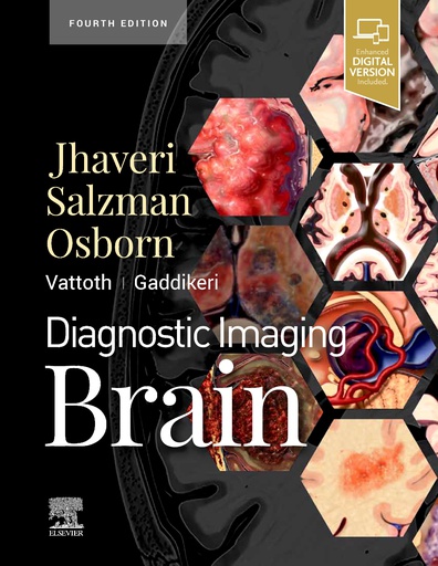 [B9780323756204] Diagnostic Imaging: Brain, 4/e