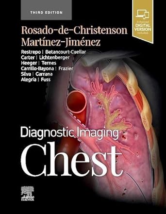 [B9780323796637] Diagnostic Imaging: Chest: 3ed