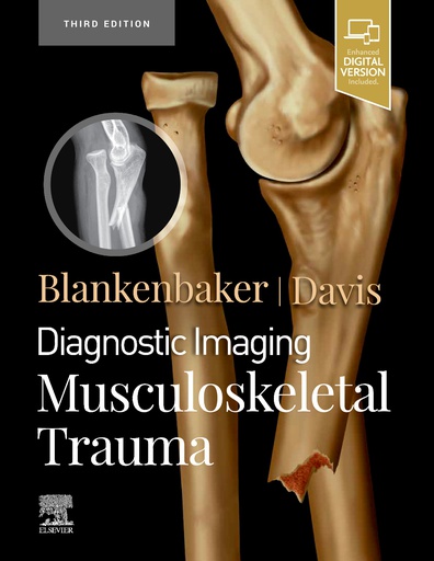 [B9780323793933] Diagnostic Imaging: Musculoskeletal Trauma, 3/e