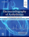 Electrocardiography of Arrhythmias: A Comprehensive Review: 2ed