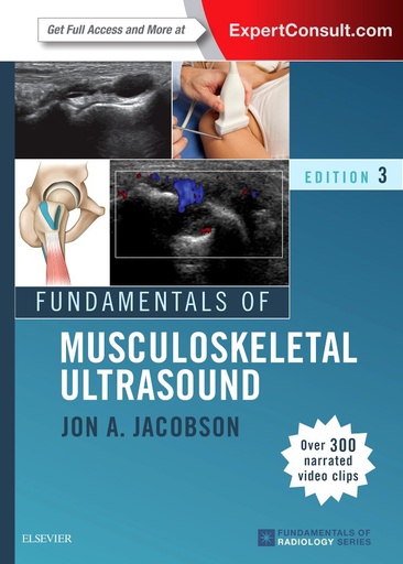 [B9780323445252] Fundamentals of Musculoskeletal Ultrasound: 3ed