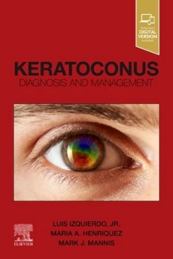 [B9780323759786] Keratoconus: Diagnosis and Management 1ed