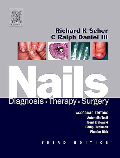 [B9781416023562] Nails: Diagnosis, Therapy, Surgery 3ed