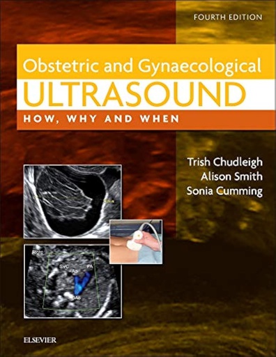 [B9780702031700] Obstetric and Gynaecological Ultrasound: How, Why and When 4ed