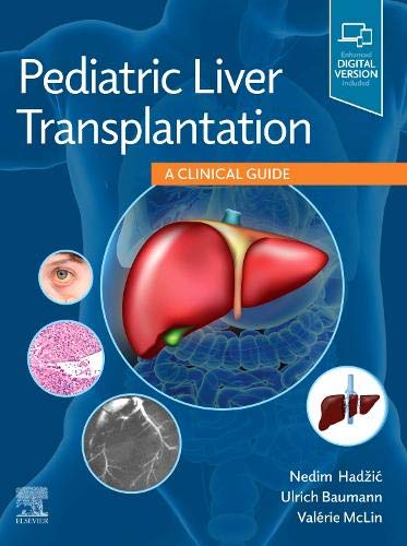 [B9780323636711] Pediatric Liver Transplantation: A Clinical Guide 1ed