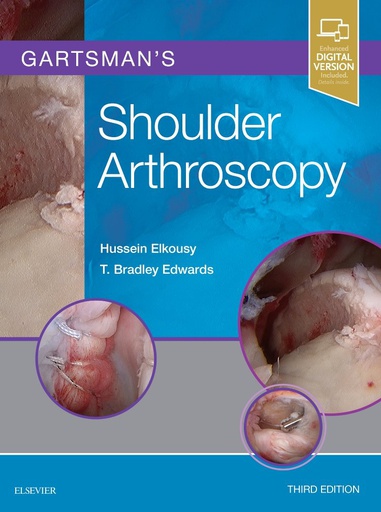 [B9780323529013] Gartsman's Shoulder Arthroscopy: 3ed