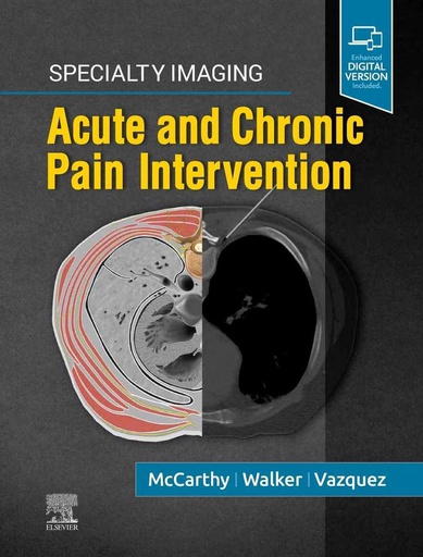 [B9780323680363] Specialty Imaging: Acute and Chronic Pain Intervention: 1ed