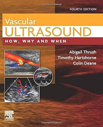 [B9780702046568] Vascular Ultrasound: How, Why and When 4ed