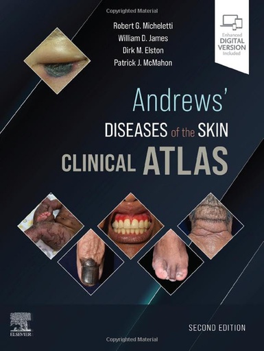 [B9780323790130] Andrews' Diseases of the Skin Clinical Atlas: 2ed