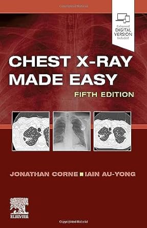 [B9780702082344] Chest X-Ray Made Easy: 5ed