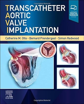 [B9780323757928] Transcatheter Aortic Valve Implantation: 1ed