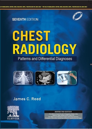 [B9788131268988] Chest Radiology: Patterns and Differential Diagnoses, 7e