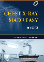 Chest X-Ray Made Easy, 5e