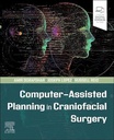 Computer-Assisted Planning in Craniofacial Surgery: 1ed