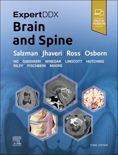 [B9780443106941] ExpertDDx: Brain and Spine: 3ed