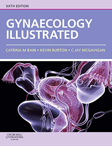 [B9780702030673] Gynaecology Illustrated: 6ed