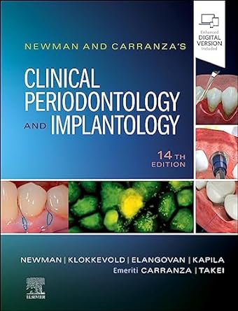 [B9780323878876] Newman and Carranza's Clinical Periodontology and Implantology: 14ed