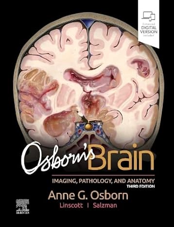 [B9780443109379] Osborn's Brain: 3ed