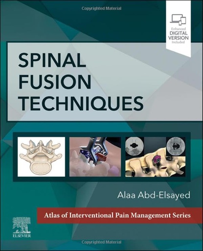 [B9780323882231] Spinal Fusion Techniques: 1ed