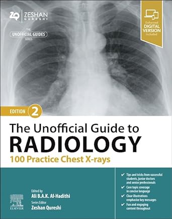 [B9780443109171] The Unofficial Guide to Radiology: 100 Practice Chest X Rays: 2ed