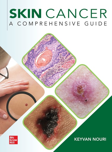 [B9781260453003] SKIN CANCER: A COMPREHENSIVE GUIDE