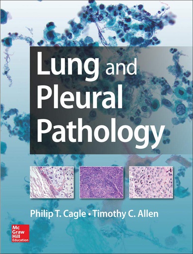 [B9780071809559] LUNG AND PLEURAL PATHOLOGY