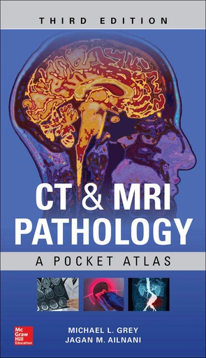 [B9781260121940] CT & MRI PATHOLOGY: A POCKET ATLAS