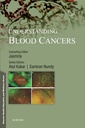 Understanding Blood Cancers, 1/e