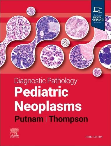 [B9780443224263] Diagnostic Pathology: Pediatric Neoplasms: 3ed