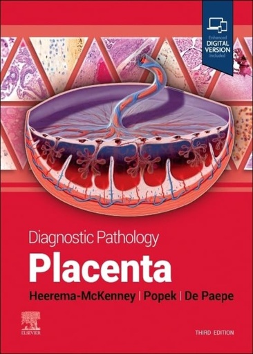 [B9780443116544] Diagnostic Pathology: Placenta: 3ed