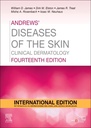 Andrews' Diseases of the Skin, IE: Clinical Dermatology 14ed